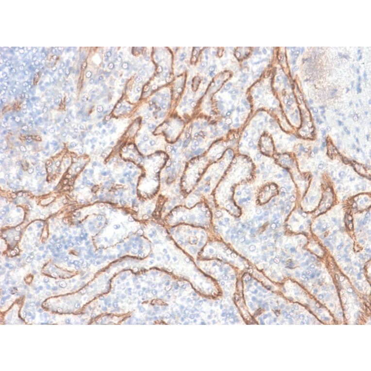Immunohistochemistry - Anti-beta Catenin Antibody [CTNNB1/2030R] - BSA and Azide free (A251483) - Antibodies.com
