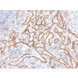 Immunohistochemistry - Anti-beta Catenin Antibody [CTNNB1/2030R] - BSA and Azide free (A251483) - Antibodies.com