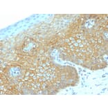Immunohistochemistry - Anti-beta Catenin Antibody [CTNNB1/2030R] - BSA and Azide free (A251483) - Antibodies.com