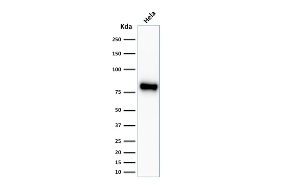 Western Blot - Anti-beta Catenin Antibody [CTNNB1/2030R] - BSA and Azide free (A251483) - Antibodies.com