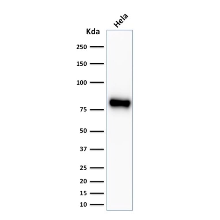 Western Blot - Anti-beta Catenin Antibody [CTNNB1/2030R] - BSA and Azide free (A251483) - Antibodies.com