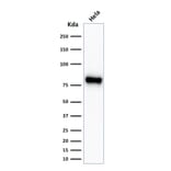 Western Blot - Anti-beta Catenin Antibody [CTNNB1/2030R] - BSA and Azide free (A251483) - Antibodies.com
