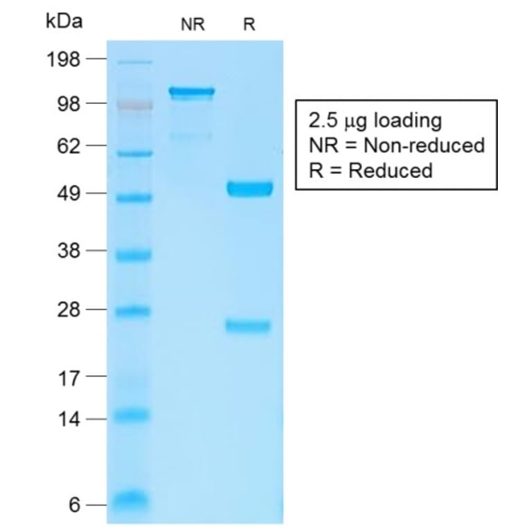SDS-PAGE - Anti-beta Catenin Antibody [CTNNB1/2030R] - BSA and Azide free (A251483) - Antibodies.com