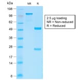 SDS-PAGE - Anti-beta Catenin Antibody [CTNNB1/2030R] - BSA and Azide free (A251483) - Antibodies.com