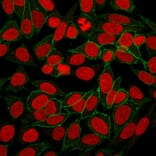Immunofluorescence - Anti-beta Catenin Antibody [CTNNB1/2030R] - BSA and Azide free (A251483) - Antibodies.com