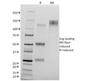 SDS-PAGE - Anti-delta 1 Catenin Antibody [25a] - BSA and Azide free (A251484) - Antibodies.com