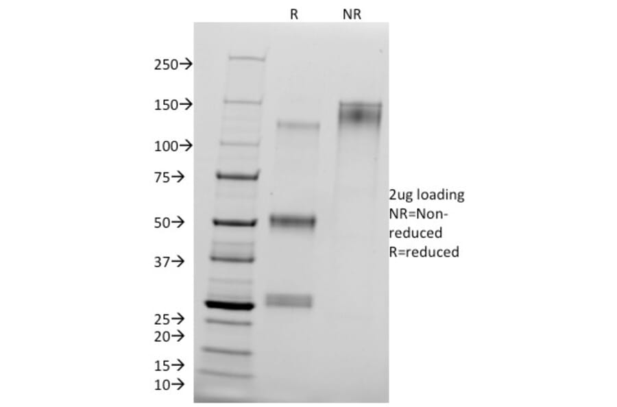 SDS-PAGE - Anti-delta 1 Catenin Antibody [25a] - BSA and Azide free (A251484) - Antibodies.com
