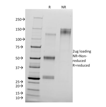 SDS-PAGE - Anti-delta 1 Catenin Antibody [25a] - BSA and Azide free (A251484) - Antibodies.com