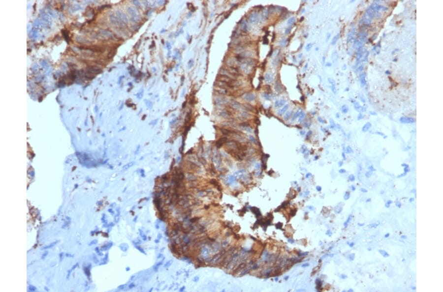 Immunohistochemistry - Anti-Cathepsin D Antibody [CTSD/2781] - BSA and Azide free (A251486) - Antibodies.com