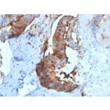 Immunohistochemistry - Anti-Cathepsin D Antibody [CTSD/2781] - BSA and Azide free (A251486) - Antibodies.com