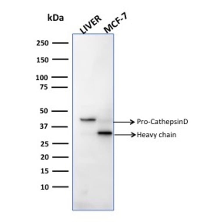 Western Blot - Anti-Cathepsin D Antibody [CTSD/2781] - BSA and Azide free (A251486) - Antibodies.com