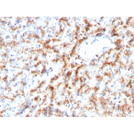 Immunohistochemistry - Anti-Cathepsin D Antibody [CTSD/3082] - BSA and Azide free (A251487) - Antibodies.com