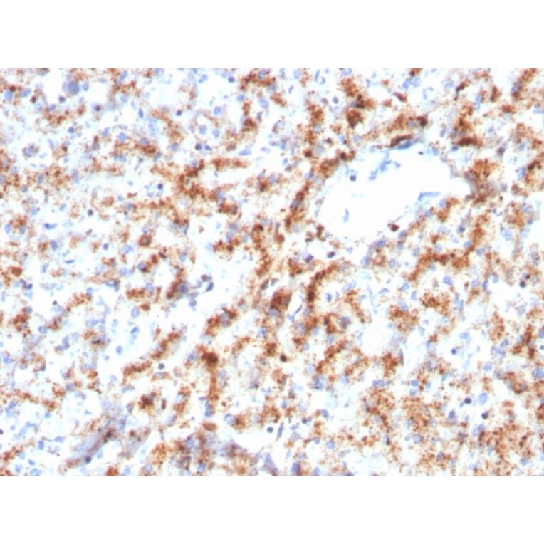 Immunohistochemistry - Anti-Cathepsin D Antibody [CTSD/3082] - BSA and Azide free (A251487) - Antibodies.com