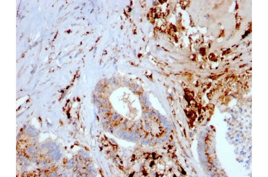 Immunohistochemistry - Anti-Cathepsin D Antibody [CTSD/3082] - BSA and Azide free (A251487) - Antibodies.com