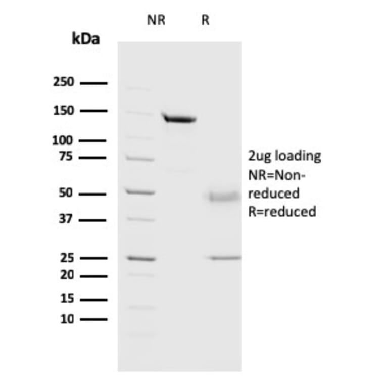 SDS-PAGE - Anti-Cathepsin D Antibody [CTSD/3082] - BSA and Azide free (A251487) - Antibodies.com