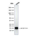 Western Blot - Anti-Cathepsin D Antibody [CTSD/3082] - BSA and Azide free (A251487) - Antibodies.com