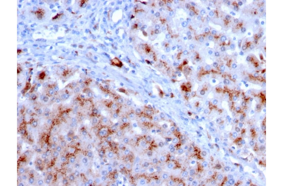 Immunohistochemistry - Anti-Cathepsin D Antibody [CTSD/3083] - BSA and Azide free (A251488) - Antibodies.com