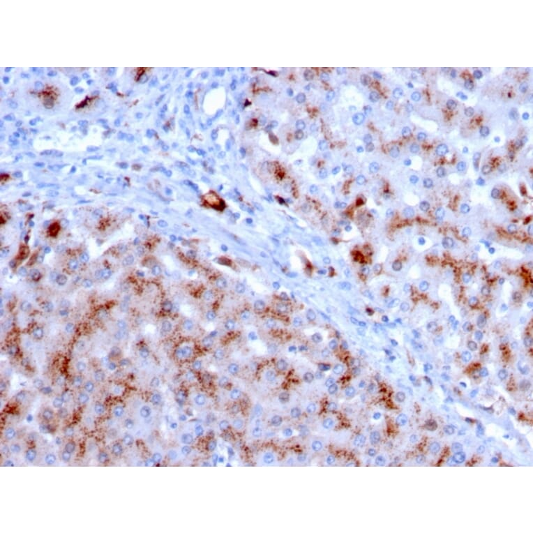 Immunohistochemistry - Anti-Cathepsin D Antibody [CTSD/3083] - BSA and Azide free (A251488) - Antibodies.com