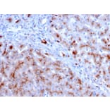 Immunohistochemistry - Anti-Cathepsin D Antibody [CTSD/3083] - BSA and Azide free (A251488) - Antibodies.com