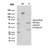 SDS-PAGE - Anti-Cathepsin D Antibody [CTSD/3083] - BSA and Azide free (A251488) - Antibodies.com