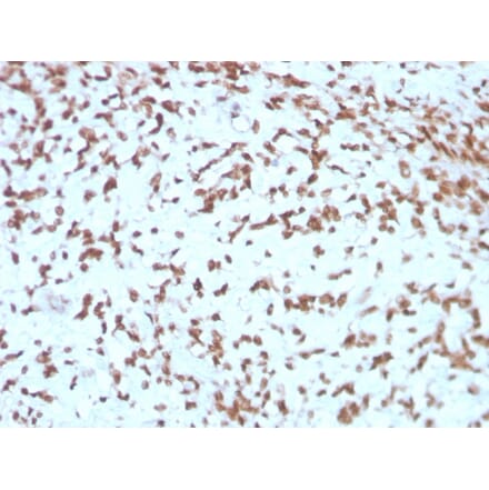 Immunohistochemistry - Anti-Cathepsin D Antibody [CTSD/3275] - BSA and Azide free (A251489) - Antibodies.com