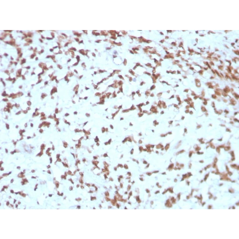 Immunohistochemistry - Anti-Cathepsin D Antibody [CTSD/3275] - BSA and Azide free (A251489) - Antibodies.com