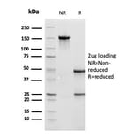 SDS-PAGE - Anti-Cathepsin D Antibody [CTSD/3275] - BSA and Azide free (A251489) - Antibodies.com