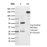 SDS-PAGE - Anti-Cathepsin D Antibody [CTSD/3276] - BSA and Azide free (A251490) - Antibodies.com