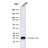 Western Blot - Anti-Cathepsin D Antibody [CTSD/3276] - BSA and Azide free (A251490) - Antibodies.com