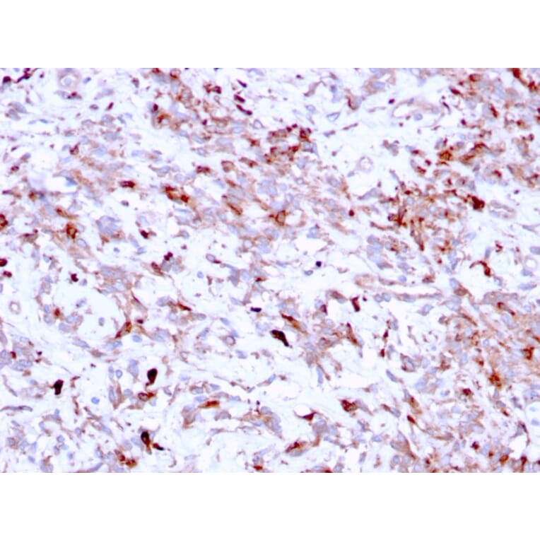 Immunohistochemistry - Anti-Cathepsin K Antibody [CTSK/2791] - BSA and Azide free (A251491) - Antibodies.com