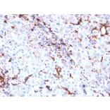 Immunohistochemistry - Anti-Cathepsin K Antibody [CTSK/2791] - BSA and Azide free (A251491) - Antibodies.com