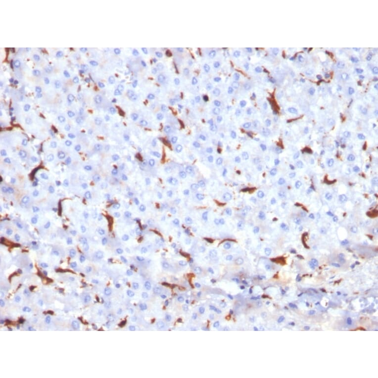 Immunohistochemistry - Anti-Cathepsin K Antibody [CTSK/2791] - BSA and Azide free (A251491) - Antibodies.com