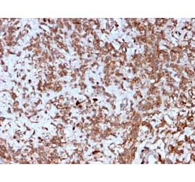 Immunohistochemistry - Anti-Cathepsin K Antibody [CTSK/2792] - BSA and Azide free (A251492) - Antibodies.com