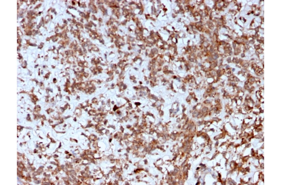 Immunohistochemistry - Anti-Cathepsin K Antibody [CTSK/2792] - BSA and Azide free (A251492) - Antibodies.com