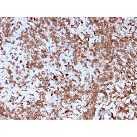 Immunohistochemistry - Anti-Cathepsin K Antibody [CTSK/2792] - BSA and Azide free (A251492) - Antibodies.com