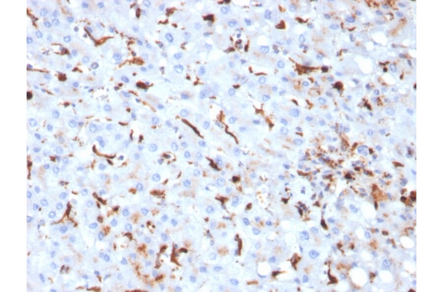 Immunohistochemistry - Anti-Cathepsin K Antibody [CTSK/2793] - BSA and Azide free (A251493) - Antibodies.com