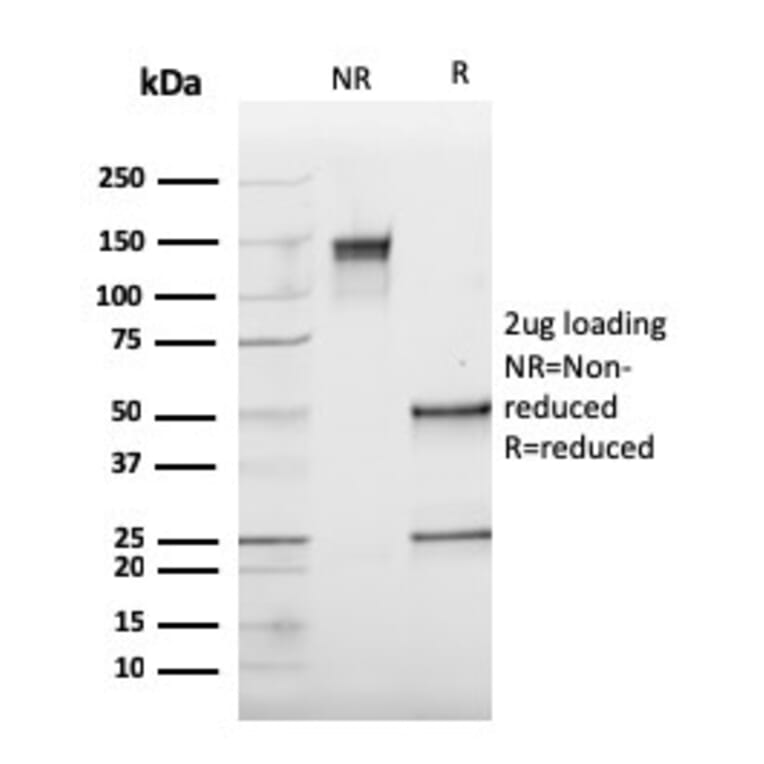 SDS-PAGE - Anti-Cathepsin K Antibody [CTSK/2793] - BSA and Azide free (A251493) - Antibodies.com