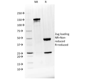 SDS-PAGE - Anti-BTLA Antibody [BTLA/1528] - BSA and Azide free (A251493) - Antibodies.com