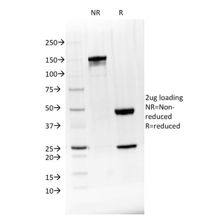 SDS-PAGE - Anti-BTLA Antibody [BTLA/1528] - BSA and Azide free (A251493) - Antibodies.com