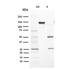 SDS-PAGE - Anti-Cytochrome P450 1A1 + 1A2 Antibody [MC1] - BSA and Azide free (A251494) - Antibodies.com