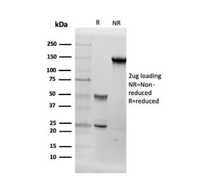 SDS-PAGE - Anti-Aromatase Antibody [CYP19A1/4257] - BSA and Azide free (A251497) - Antibodies.com
