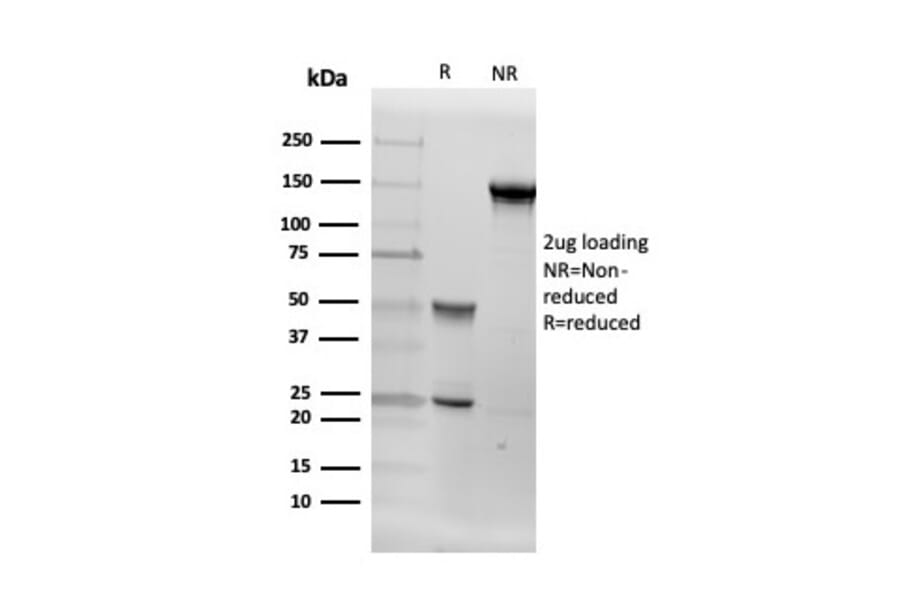 SDS-PAGE - Anti-Aromatase Antibody [CYP19A1/4257] - BSA and Azide free (A251497) - Antibodies.com