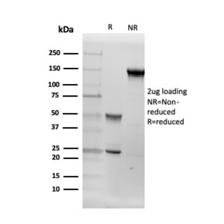 SDS-PAGE - Anti-Aromatase Antibody [CYP19A1/4257] - BSA and Azide free (A251497) - Antibodies.com