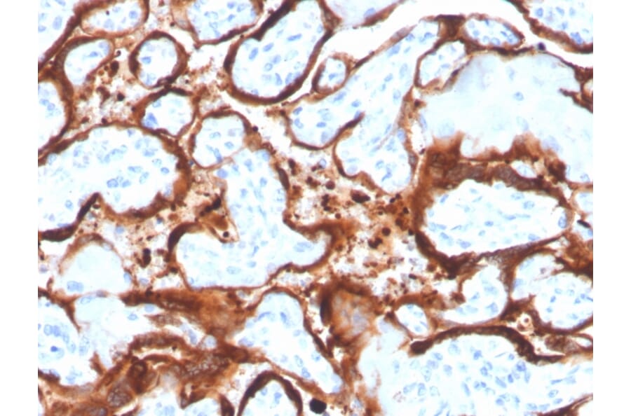 Immunohistochemistry - Anti-Aromatase Antibody [CYP19A1/4257] - BSA and Azide free (A251496) - Antibodies.com