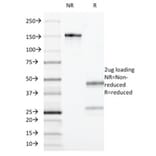 SDS-PAGE - Anti-CD55 Antibody [F4-29D9] - BSA and Azide free (A251498) - Antibodies.com