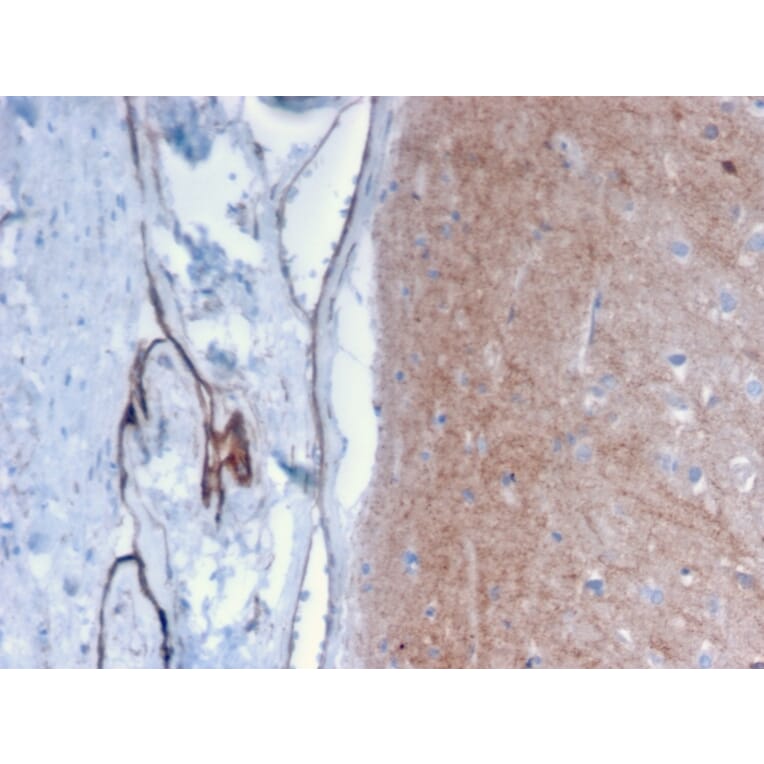 Immunohistochemistry - Anti-Drebrin Antibody [DBN1/2879] - BSA and Azide free (A251503) - Antibodies.com