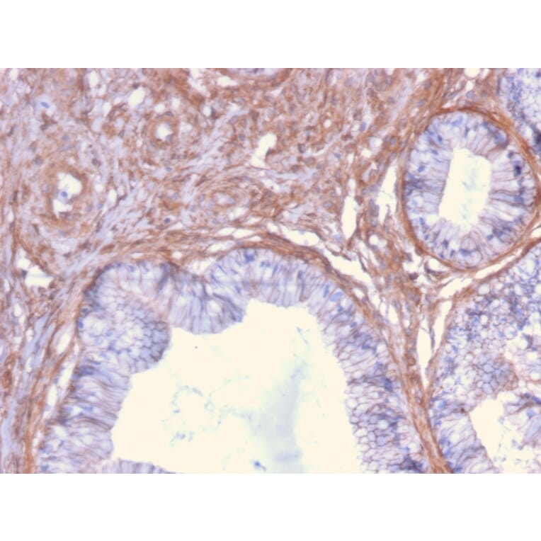 Immunohistochemistry - Anti-Drebrin Antibody [DBN1/2879] - BSA and Azide free (A251503) - Antibodies.com