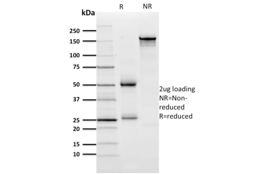 SDS-PAGE - Anti-ZNF846 Antibody [ZNF846/2687] - BSA and Azide free (A251506) - Antibodies.com