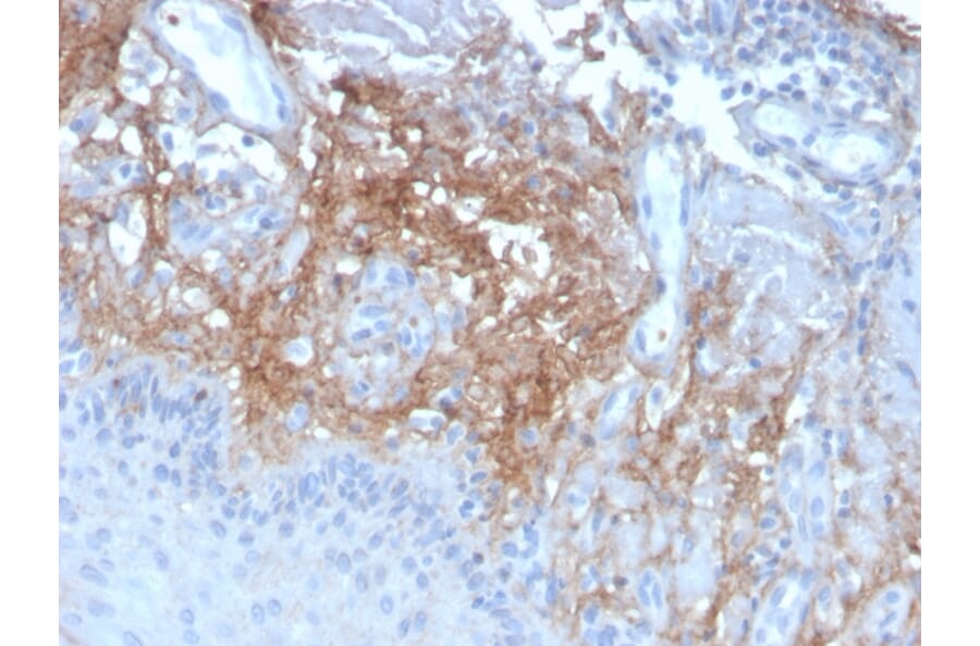 Immunohistochemistry - Anti-Decorin Antibody [DCN/3523] - BSA and Azide free (A251507) - Antibodies.com