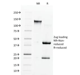 SDS-PAGE - Anti-Angiotensin Converting Enzyme 1 Antibody [9B9] - BSA and Azide free (A251507) - Antibodies.com